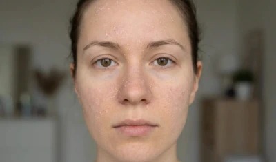 डेड स्किन से छुटकारा पाने के ये हैं आसान तरीके