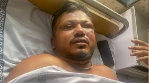 अहमदाबाद प्लेन क्रैश :  उड़ते ताबूत से जिंदा निकले शख्स ने बताई मौत की दास्तां