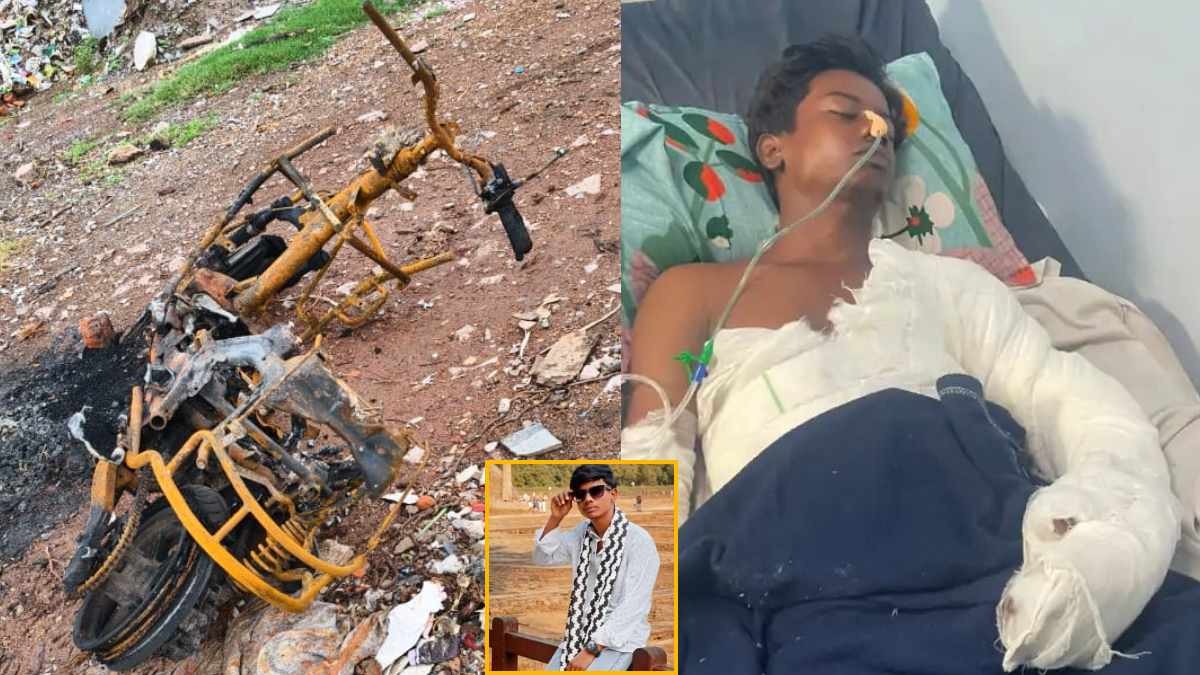  रायपुर में शराब पार्टी के बहाने बुलाया, फिर पेट्रोल डालकर जिंदा जलाने का आरोप... 7 दिन बाद युवक की मौत