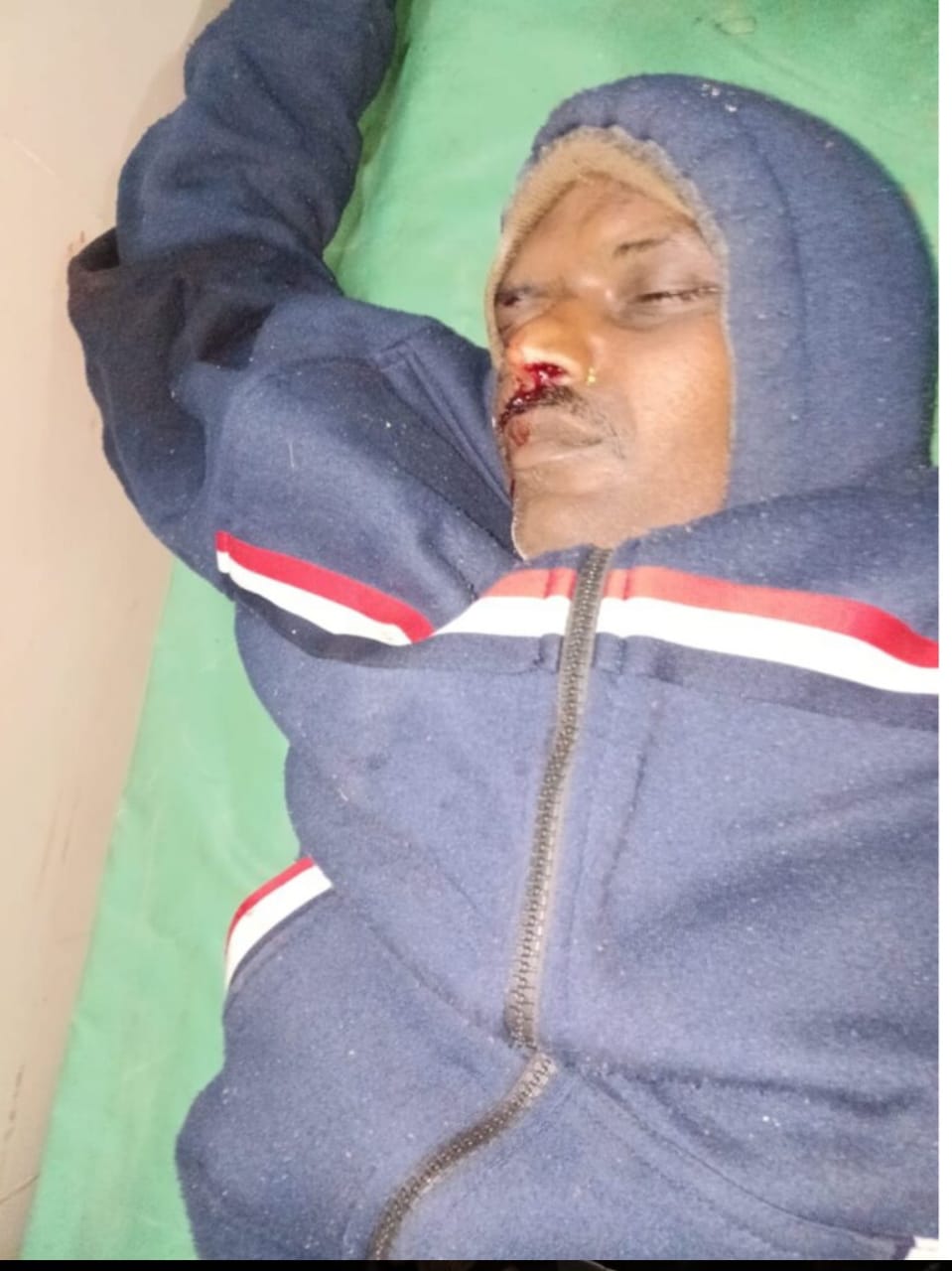 सड़क हादसे में ग्रामीण की मौत मर्ग कायम कर जांच में जुटी पुलिस 