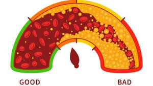सर्दियों में ये फूड तेजी से बढ़ा देते हैं बैड कोलेस्ट्रॉल,इन बातों का रखें ध्यान 