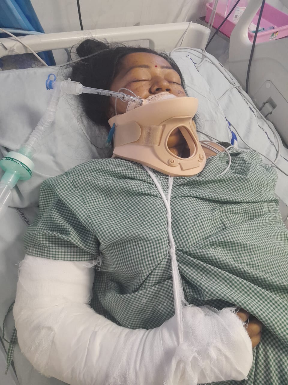  रायपुर-किरंदुल मार्ग पर हादसा: अनियंत्रित कार पलटी, महिलाएं-बच्चे समेत 8 घायल
