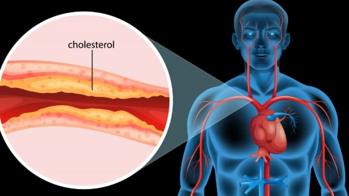HDL Cholesterol Level: शरीर में कितना होना चाहिए गुड कोलेस्ट्रॉल? जानिए हार्ट को हेल्दी रखने के लिए सही HDL लेवल और इसे बढ़ाने के आसान उपाय