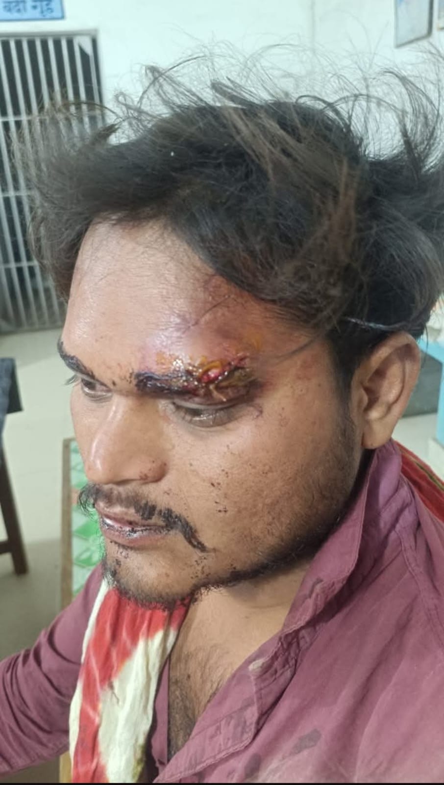 ओवररेट शराब से शुरू हुआ विवाद, कर्मचारी पर मारपीट का आरोप — आबकारी विभाग की भूमिका पर उठे गंभीर सवाल
