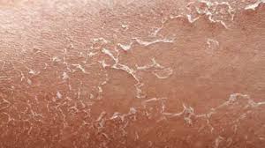 फ्लीकी और झुर्रियों वाली स्किन से हैं परेशान तो अपनाएं ये उपाय 