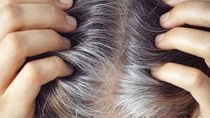 कम उम्र में सफेद बालों की समस्या,जानें कारण और समाधान