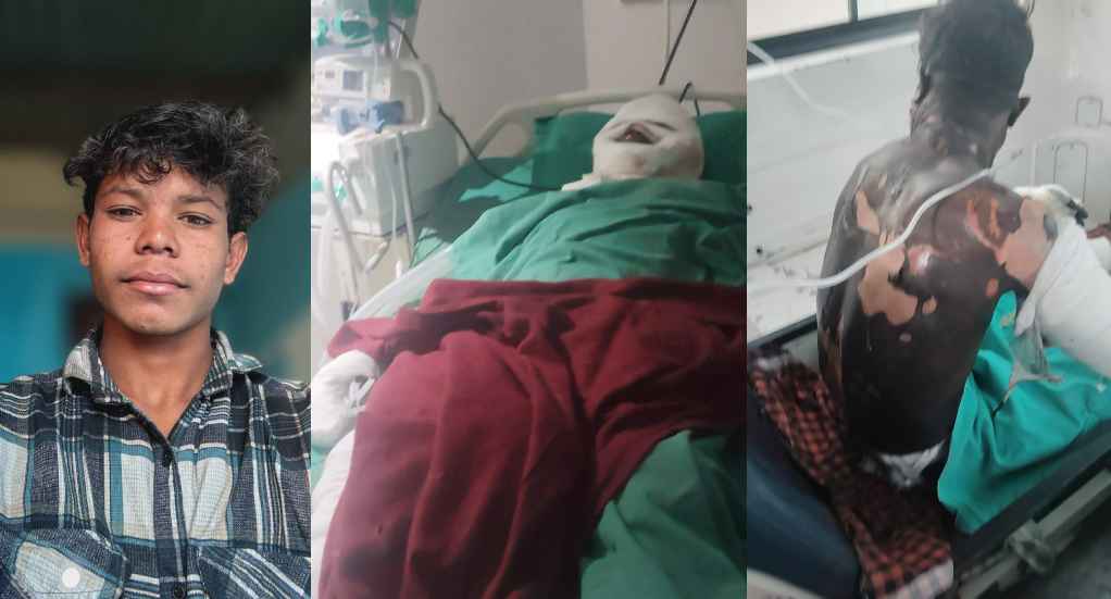 मंगल कार्बन प्लांट हादसा: नौ माह की मासूम के बाद पिता और युवक की भी मौत