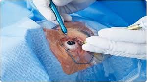 बीजापुर में डॉक्टरों की बड़ी लापरवाही,छीन गई 9 मरीजों की आँखों की रोशनी 