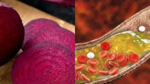 बढ़े हुए कोलेस्ट्रॉल को कम करने के लिए अपनाएं यह डाइट टिप