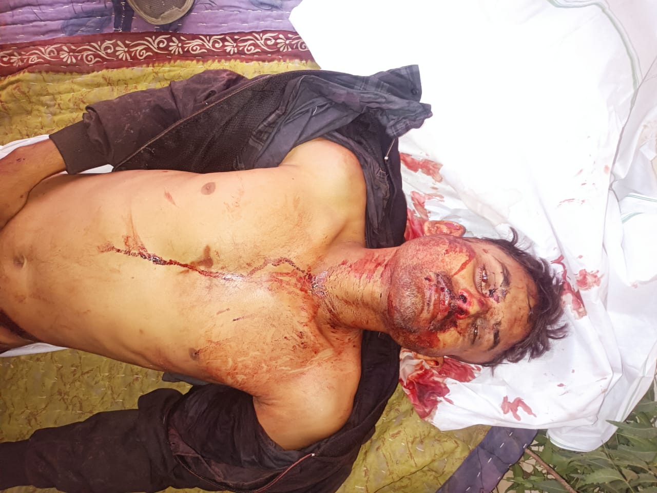 ट्रेक्टर से गिरकर युवक की मौत मर्ग कायम कर जांच में जुटी पुलिस