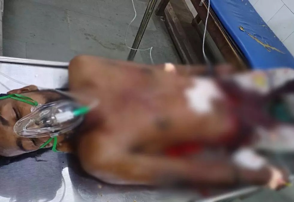 न्यायधानी में आपसी रंजिश के चलते युवक पर चाकू से ताबड़तोड़ हमला 