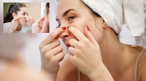 ये है आसान और सरल उपाय जो दिलाएंगे पिंपल्स और ऑयली स्किन से छुटकारा
