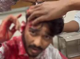 गणेश पंडाल के पास युवकों ने गुंडागर्दी करते हुए जमकर मचाया बवाल,युवक को किया अधमरा