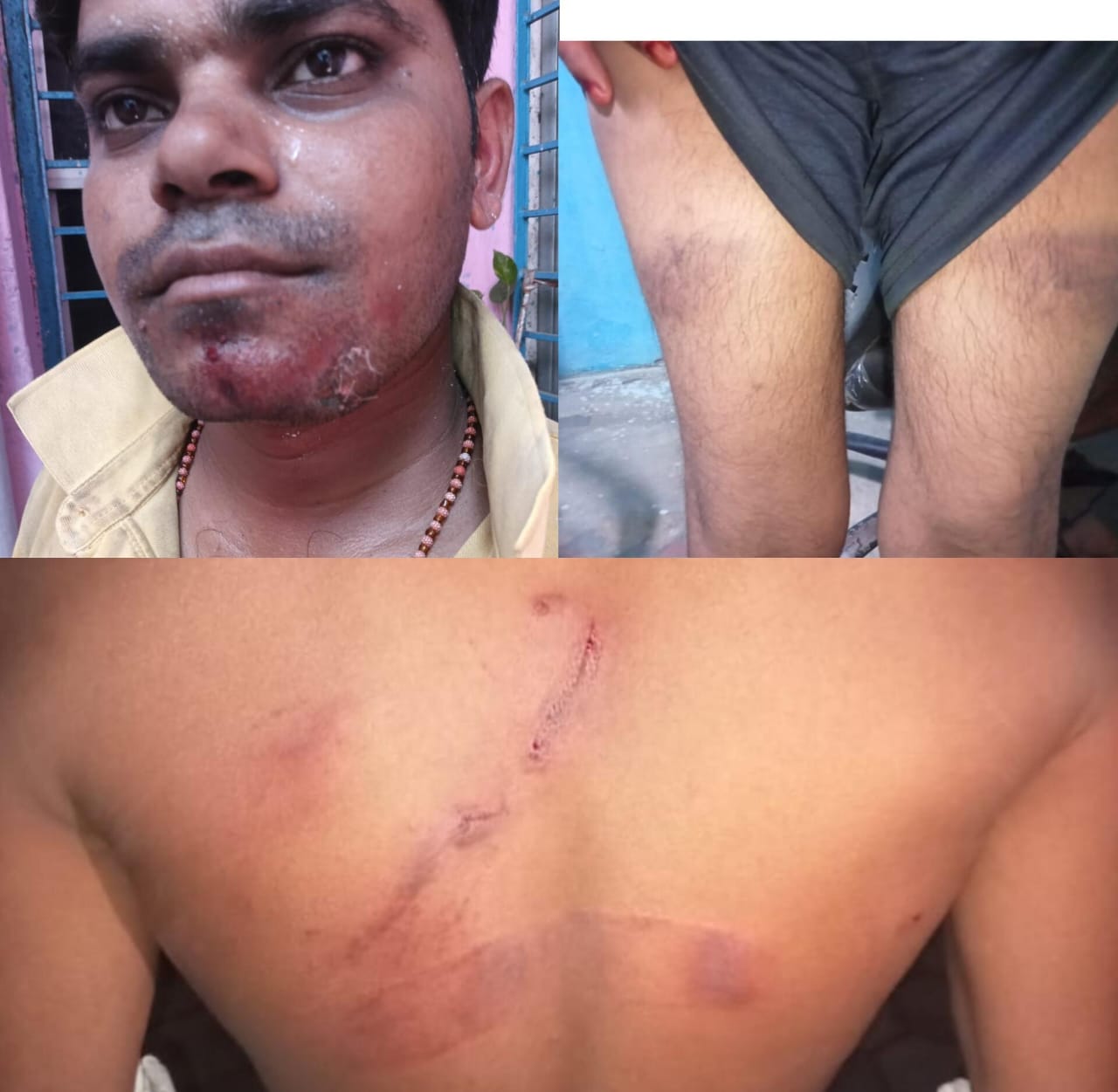रक्षक या भक्षक? बलौदा पुलिस की बर्बरता उजागर, बारात से लौटते लोगों पर कहर