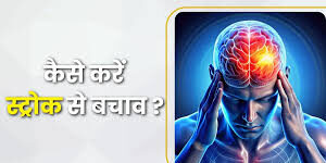 World Stroke Day : युवा हो रहे ब्रेन स्ट्रोक के शिकार डॉक्टर बोले- "खराब लाइफस्टाइल बन रहा खतरे की घंटी" 