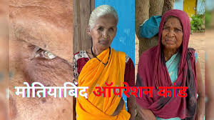  मोतियाबिंद ऑपरेशन कांड : अंधेरे में डूबी जिंदगी, न रोशनी लौटी न मिला मुआवजा, झकझोर देगी इनकी कहानी