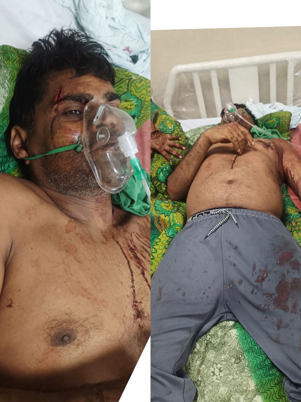 गाली-गलौज का विरोध पड़ा भारी, पूर्व जनपद सदस्य प्रतिनिधि पर कुल्हाड़ी से हमला