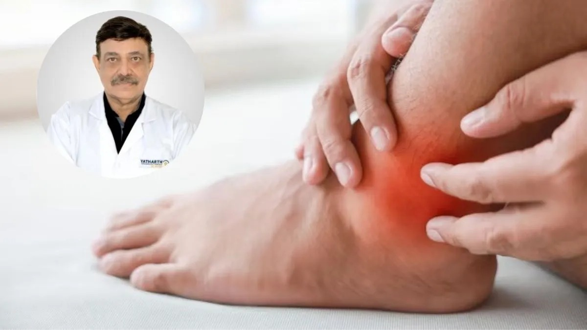 आम खाने के शौकीन हैं? पहले जान लें यूरिक एसिड मरीजों के लिए कितना सुरक्षित है