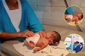 कलयुगी मां की काली करतूत : मासूम नवजात बच्ची को नाले के किनारे प्लास्टिक की थैली में फेंका 