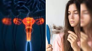 इन लक्षणों से महिलाएं PCOS की करें पहचान 