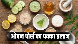 ओपन पोर्स से पाएं छुटकारा, घर पर बनाएं ये असरदार फेस मास्क 