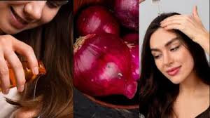 बाल झड़ने की समस्या से हैं परेशान और चाहिए घने लम्बे बाल तों प्याज का ऐसे करें इस्तेमाल 