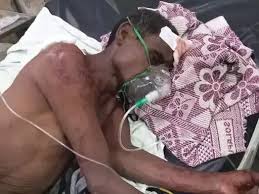 बिलासपुर में जेल से छूटे हत्या के आरोपी ने गवाही देने की रंजिश में युवक पर किया चाकू से ताबड़तोड़ हमला…