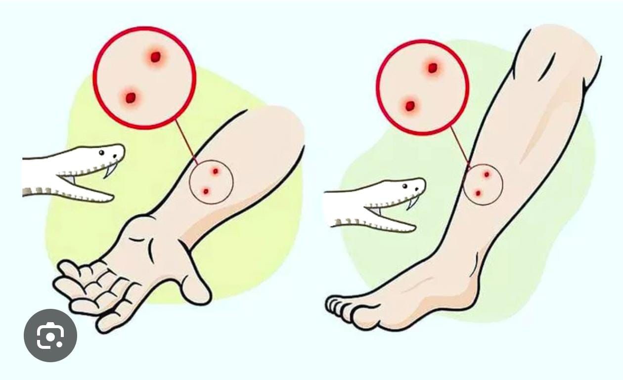 सांप डसे तो झाड-फूक में समय न गवाएं, शीघ्र अस्पताल पहुंचे..सर्पदंश से बचने स्वास्थ्य विभाग ने जारी किया एडवाइजरी