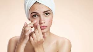 चेहरे पर मुँहासे से बचने के अपनाएं ये टिप्स 