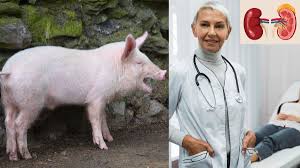 सुअर की किडनी को इंसान के शरीर में लगाकर बचाई जा सकेगी जिंदगी, चल रहा क्लीनिकल ट्रायल